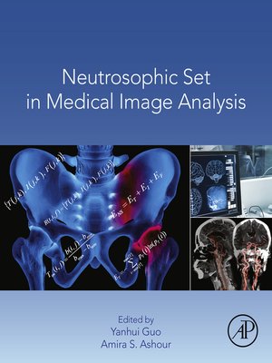 cover image of Neutrosophic Set in Medical Image Analysis